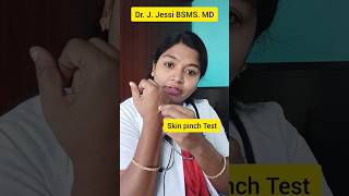 skin pinch Test dehydration siddha ayurveda siddhamedicine health [upl. by Aerdnas21]