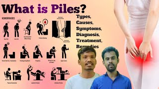 What is Piles Types Causes Symptoms DiagnosisTreatment Remedies [upl. by Lau768]