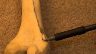 Anatomy and Osteology of the Femur [upl. by Nostaw410]