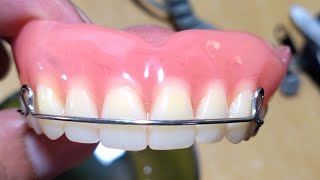 Pustiso with Retainer or Denture with Retainer [upl. by Ettenoj942]