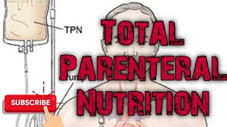 Total Parenteral Nutrition  Hyper alimentation [upl. by Otnas]