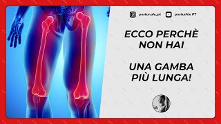 BACINO DISALLINEATO ECCO PERCHÈ NON HAI UNA GAMBA PIÙ LUNGA [upl. by Sadonia]