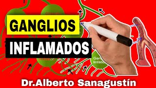 Signos PELIGROSOS en GANGLIOS LINFÁTICOS INFLAMADOS Adenopatías [upl. by Nimrak763]