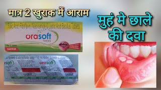 मुहं के छाले की टेबलेट Orasoft Mouth Ulcer tablet uses in hindi  ओरासोफ्ट टेबलेट [upl. by Maridel]