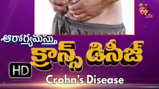 Aarogyamastu  Crohns Disease  20th January 2017  ఆరోగ్యమస్తు [upl. by Almund703]