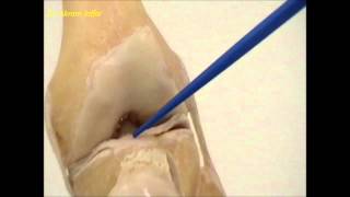 Anatomy of the knee joint [upl. by Yekcaj]