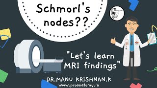 MRI findings What are schmorls nodes [upl. by Asum930]