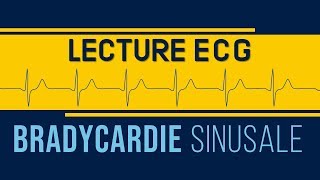 Interprétation ECG  Bradycardie Sinusale [upl. by Luahs]