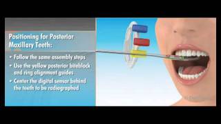 Dentsply Rinn XCPDS FIT Dentrek Module [upl. by Okoy]