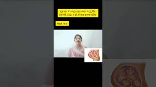 twins pregnancy shuruaat me kaise clear kre ultrasound me twins pregnancy kaise pata kre [upl. by Louanna646]