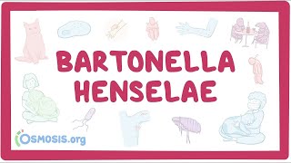 Bartonella henselae  an Osmosis Preview [upl. by Zaneski]