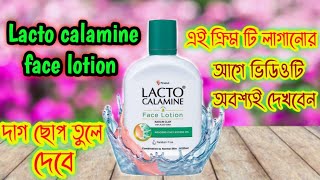 Lacto calamine face lotion review in Bengaliলাক্ট ক্যালামাইন ক্রিম সম্পর্কে সত্যিটা জানুন [upl. by Alvis406]