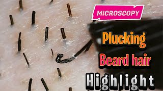 Plucking Beard hair  Hair Removal 3 [upl. by Roper]