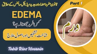 Edema lecture in Urdu Hindi P1  Edema vs Inflammation  Hydrostatic and Osmotic Pressure  Albumin [upl. by Kitchen]