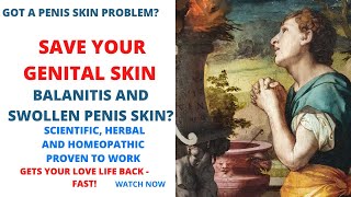 How to Get Rid of Penile Balanitis Save Your Foreskin [upl. by Yellah964]