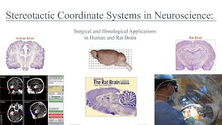 Stereotactic Coordinate Systems in Neuroscience and Medicine Applications in Rat and Human Brain [upl. by Scriven758]