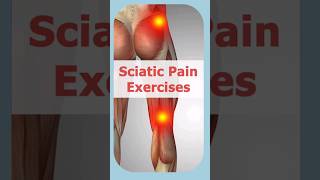 Best Sciatica Relief Pain Exercises  Sciatica Pain Treatment sciaticapain sciaticapainrelief [upl. by Rand345]