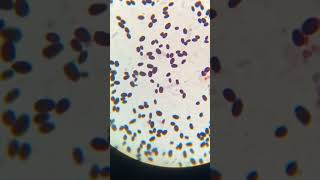 Candida species in urine culture microscope microbiology bmltlecture study music [upl. by Aissilem]