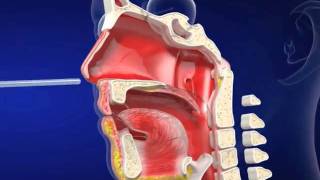 Nasogastric eLearning from Vygon UK Ltd [upl. by Aidahs104]