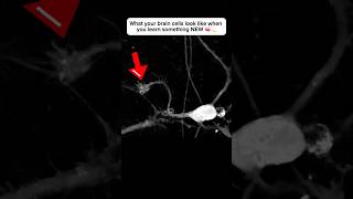 Brain cell restructures itself after forming a new connection neuroplasticity neuroscience brain [upl. by Myrvyn]