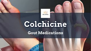 colchicine  Uses Dosage Side Effects amp Mechanism  Colcrys [upl. by Gardell]