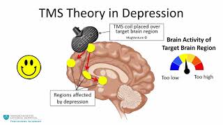 Transcranial Magnetic Stimulation A New Treatment Approach for Psychiatric Disorders [upl. by Bakki]