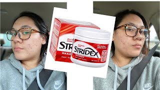 TRYING STRIDEX FOR A WEEK  MY ACNE JOURNEY [upl. by Uchida210]