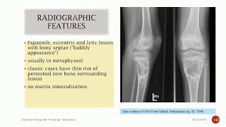 Aneurysmal Bone Cyst [upl. by Wylen]