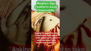 Murphys Sign  Acute Cholecystitis learning medicalstudent bams mbbs shorts viral [upl. by Nylram]