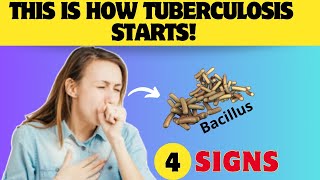 Your Cough Could Be Tuberculosis 🚨 [upl. by Notnilk]