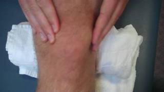 physical therapy guru patellar mobilizations [upl. by Eniamrehs91]