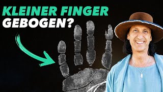 Die schockierende Wahrheit hinter dem kleinen gebogenen Finger [upl. by Nyloc972]