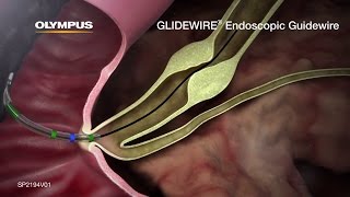 GLIDEWIRE Endoscopic Hydrophilic Coated Guidewire Animation [upl. by Aviva]