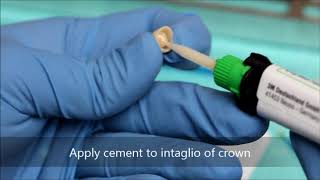 Bonding a zirconia crown [upl. by Ney]