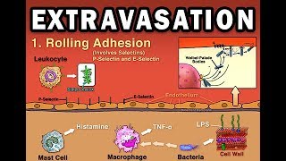 EXTRAVASATION [upl. by Jessica]