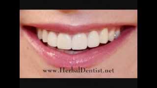 Herbal Dentist  1 Natural Gum Disease Remedy wwwherbaldentistnet [upl. by Linnette]