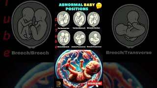 Baby positions in the womb  Abnormal baby positions in the womb  Fetal movement shortsfeed baby [upl. by Vasiliu]