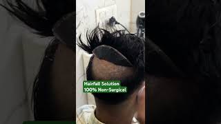 hairfall solution hair wig for men mintop 5 9643765000 [upl. by Senoj]