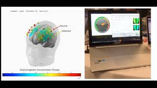 Team quotBright Teamquot fNIRS Motor Imagery  IEEE SMC Banff 2017 Hackathon [upl. by Nannette]