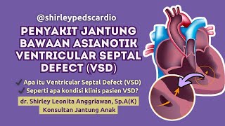 Mengenal Ventricular Septal Defect VSD atau Defek Septum Ventrikel [upl. by Edina718]