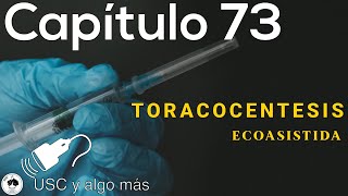 Capítulo 73 Toracocentesis Ecoasistida [upl. by Hewie74]