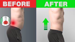 How To Fix Your Excessive Lumbar Lordosis To Reduce Pain amp Improve Movement [upl. by Leboff998]