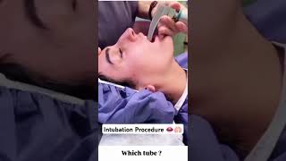 Intubation procedure in 5 seconds 👄🫁 shorts intubation trending youtubeshorts love song [upl. by Coppola928]