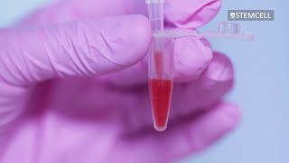 How to Deplete Red Blood Cells from Small Volume Samples with HetaSep™ [upl. by Irotal922]