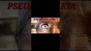 Pseudophakia l Ophthalmology l Medicine l Crazy medz l shorts [upl. by Holub]