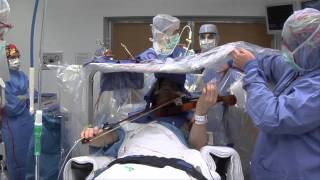 Violinist Still Making Music After DBS Surgery  Mayo Clinic [upl. by Karrie]