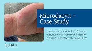 Microdacyn Hydrogel Case Study  the sting free wound care spray that helps reduce infection [upl. by Addiel61]