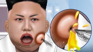 ASMR Facial care for Kim JongUn  Skincare Animation  Removal Ingrown Hair Sebum Shaving [upl. by Ataliah805]