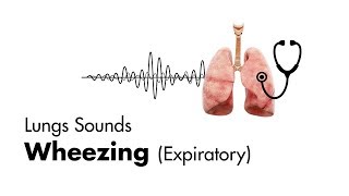 Wheezing expiratory  Lung Sounds  MEDZCOOL [upl. by Ardnaeed]