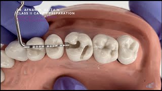 Class II cavity preparation for amalgam  maxillary molar 26  Preclinical Operative  Arabic عربي [upl. by Ibbed]